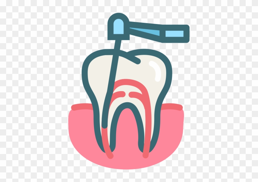 root canal treatment